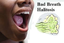  Bad Breath Halitosis