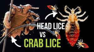 liceandcrabs